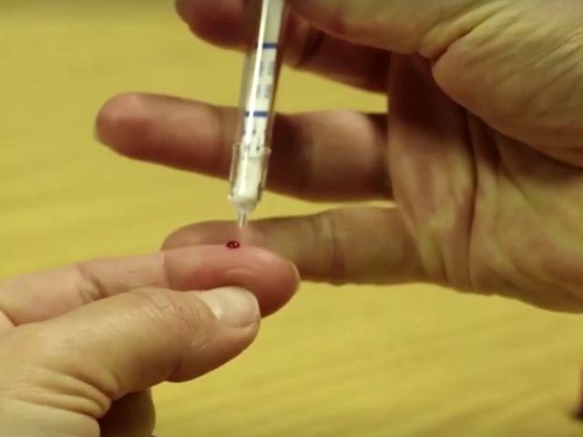 Farmácias vão poder fazer testes rápidos para diagnosticar COVID-19