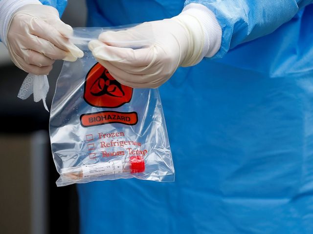 Brasil registra 11.130 casos de covid-19 e 486 mortes