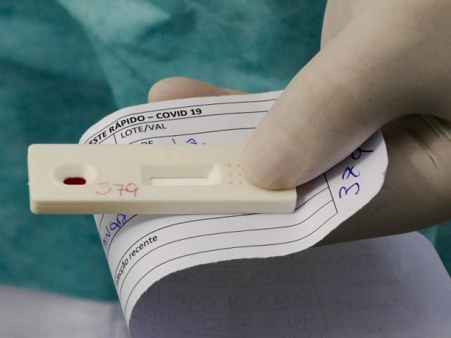 Estado distribui a municípios mais 135 mil testes rápidos para detecção de anticorpos do coronavírus