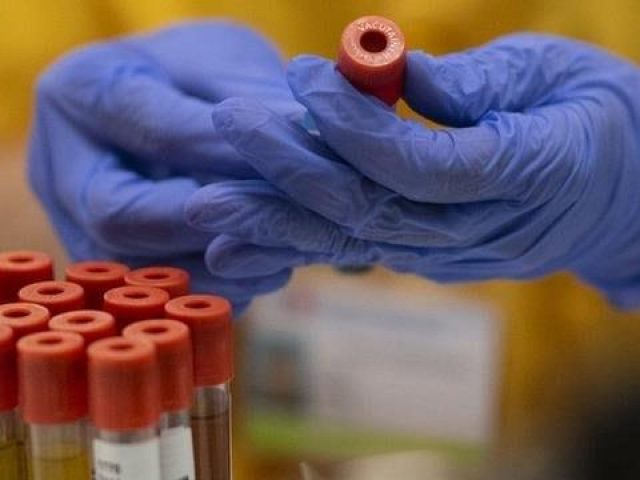 Vacina de Oxford para Covid-19 já é produzida em massa em 4 países