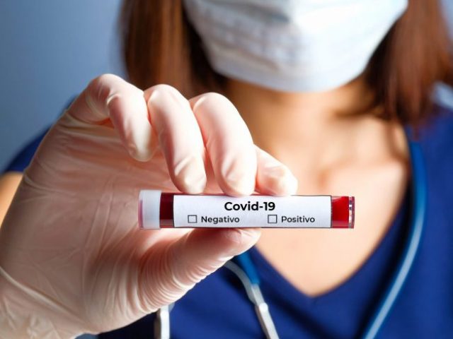 Covid-19: Brasil chega a 526,4 mil casos e 29,9 mil mortes